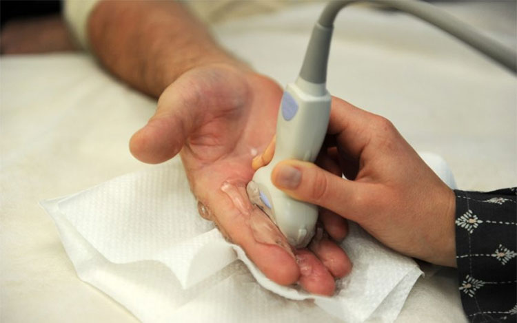 اولتراسوند درمانی آرتروز مچ دست