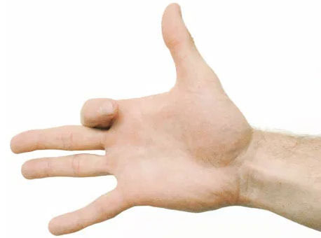ورزش‌های مناسب برای درمان آرتروز مچ دست