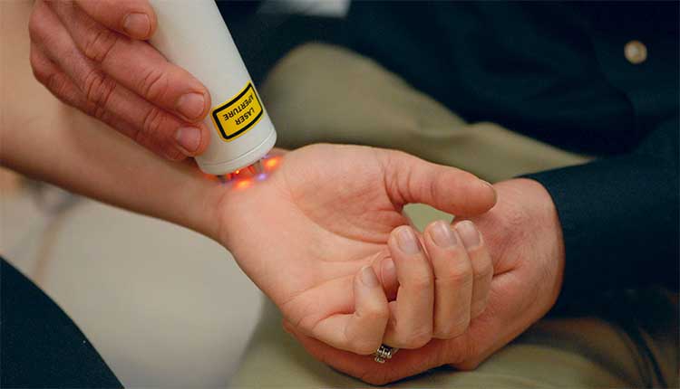 درمان انگشت ماشه ای با لیزر
