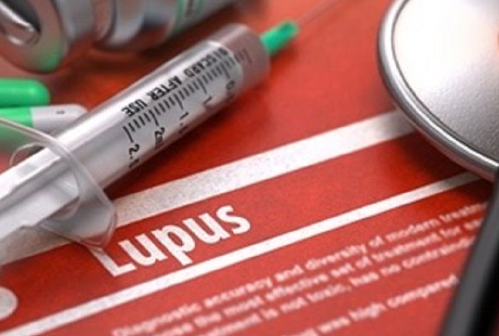 درمان قطعی لوپوس