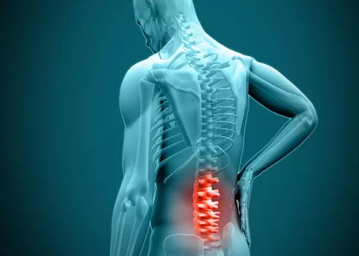 علائم خطرناک‌ ترین دیسک کمر