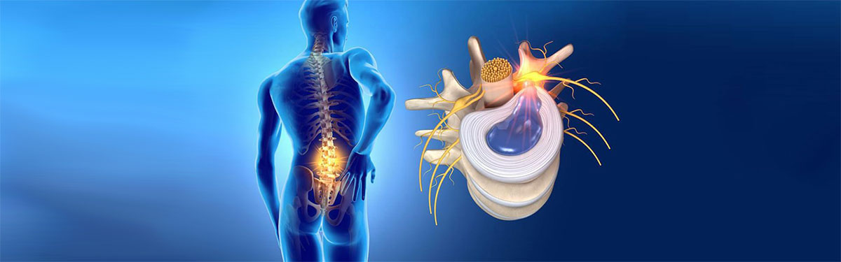 دیسک بین مهره ای و نقش آن در بدن