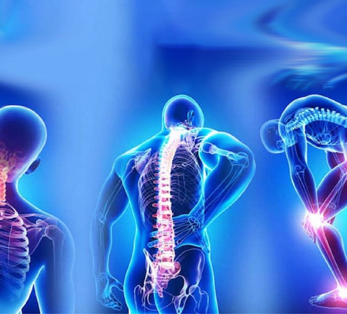 تشخیص فیبرومیالژیا چگونه است