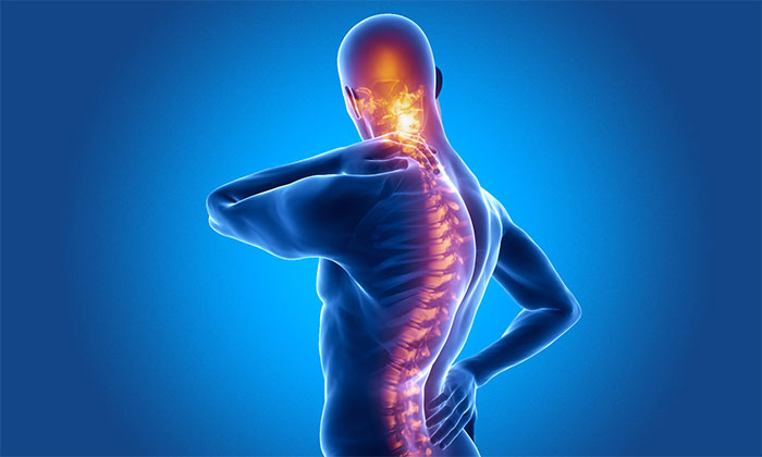 اسپوندیلیت آنکیلوزان چیست؟