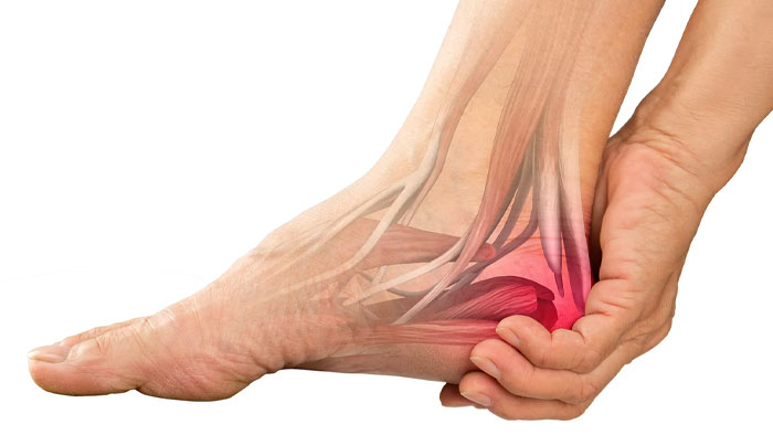 علائم سندروم تونل تارسال