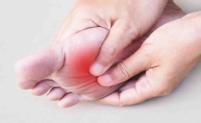 علت داغی و سوزش کف پا