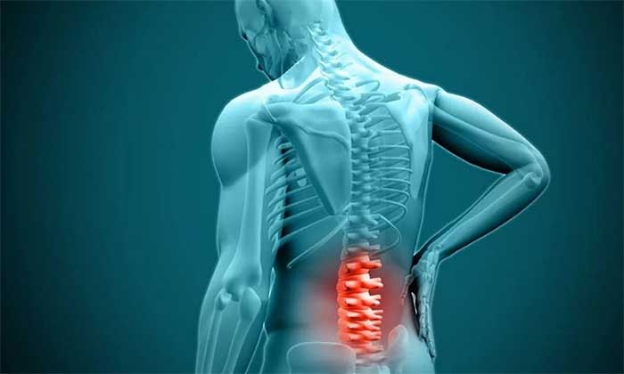 دیسک کمر چیست؟