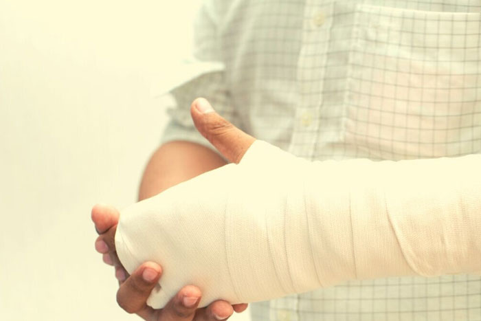 عمل جراحی شکستگی مچ دست چگونه است؟