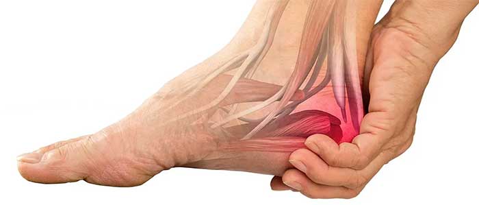 سندرم تونل تارسال