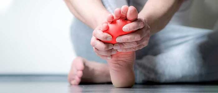 سندرم درد منطقه‌ای پیچیده (CRPS)